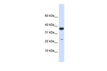 UBE2D2 Rabbit Polyclonal Antibody