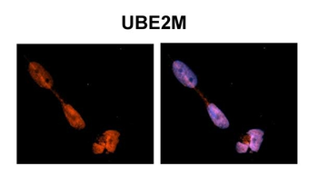 UBE2M Rabbit Polyclonal Antibody