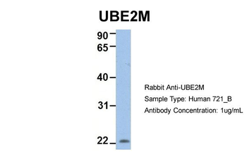 UBE2M Rabbit Polyclonal Antibody