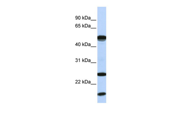 UBE2L6 Rabbit Polyclonal Antibody