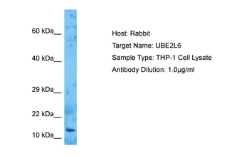 UBE2L6 Rabbit Polyclonal Antibody
