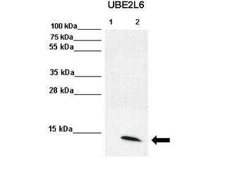 UBE2L6 Rabbit Polyclonal Antibody