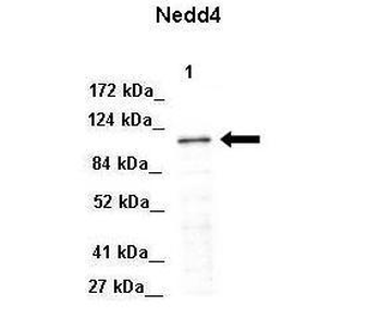 NEDD4 Rabbit Polyclonal Antibody