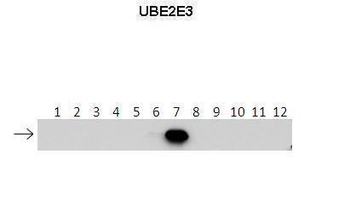 UBE2E3 Rabbit Polyclonal Antibody