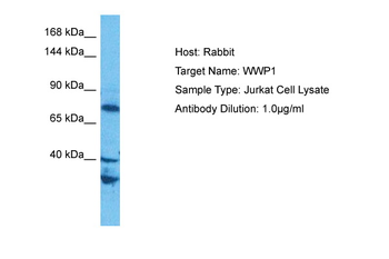 WWP1 Rabbit Polyclonal Antibody