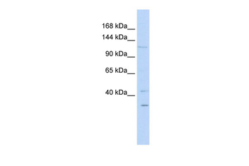 WWP1 Rabbit Polyclonal Antibody