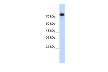 WWP2 Rabbit Polyclonal Antibody