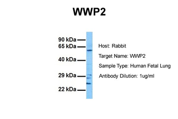 WWP2 Rabbit Polyclonal Antibody