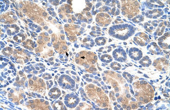 WWP2 Rabbit Polyclonal Antibody