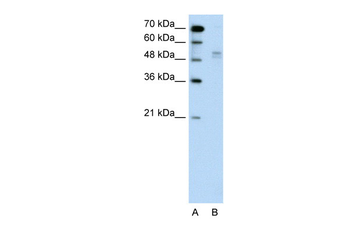 WWP2 Rabbit Polyclonal Antibody