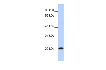 WWP2 Rabbit Polyclonal Antibody