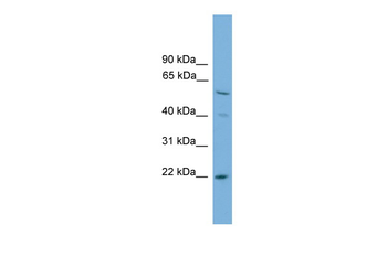 UBE2T Rabbit Polyclonal Antibody