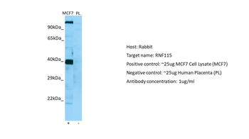 ZNF364 Rabbit Polyclonal Antibody