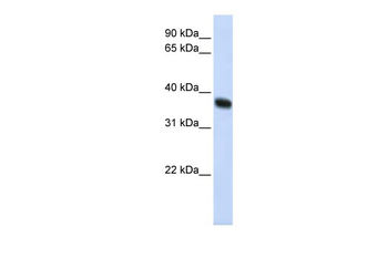 ZNF364 Rabbit Polyclonal Antibody