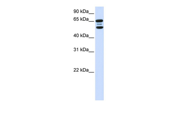 FBXO21 Rabbit Polyclonal Antibody