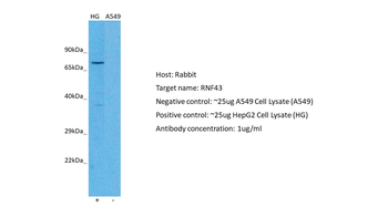 RNF43 Rabbit Polyclonal Antibody