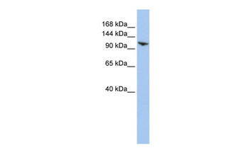 RNF20 Rabbit Polyclonal Antibody