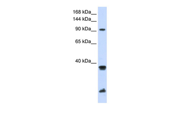 RNF20 Rabbit Polyclonal Antibody