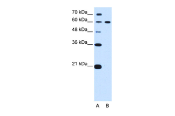 DTX2 Rabbit Polyclonal Antibody