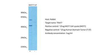 TRAF7 Rabbit Polyclonal Antibody