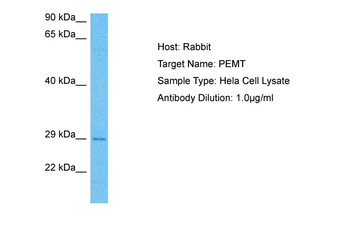 PEMT Rabbit Polyclonal Antibody
