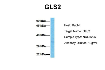 GLS2 Rabbit Polyclonal Antibody