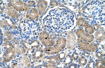 GLS2 Rabbit Polyclonal Antibody