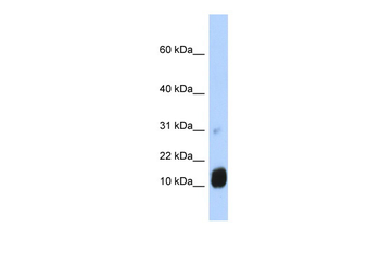 GCHFR Rabbit Polyclonal Antibody