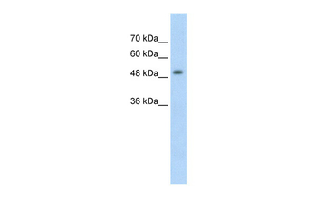 MECP2 Rabbit Polyclonal Antibody