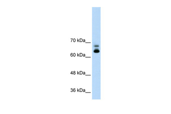 MTA2 Rabbit Polyclonal Antibody