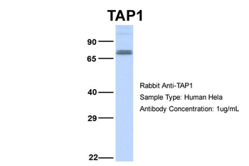 TAP1 Rabbit Polyclonal Antibody