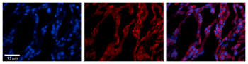TAP1 Rabbit Polyclonal Antibody