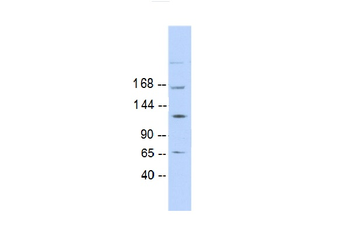 RAD50 Rabbit Polyclonal Antibody