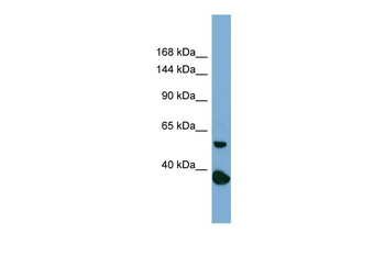 RAD50 Rabbit Polyclonal Antibody