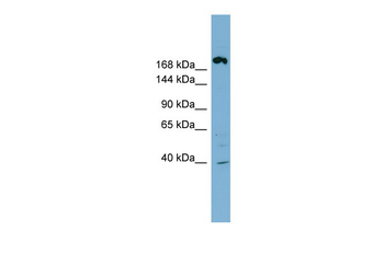 ABCC11 Rabbit Polyclonal Antibody