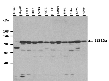 SLC12A3 Rabbit Polyclonal Antibody