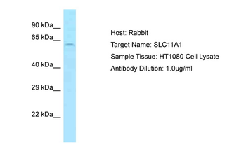 SLC11A1 Rabbit Polyclonal Antibody