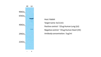 SLC11A1 Rabbit Polyclonal Antibody