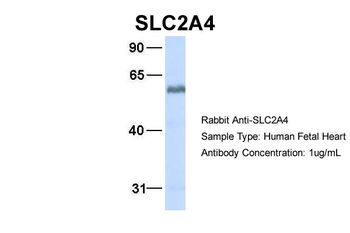 SLC2A4 Rabbit Polyclonal Antibody