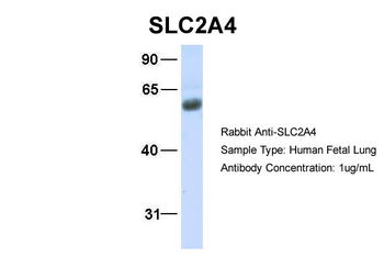 SLC2A4 Rabbit Polyclonal Antibody