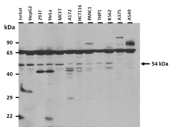 SLC38A1 Rabbit Polyclonal Antibody