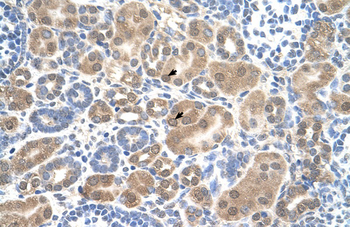 SLC38A1 Rabbit Polyclonal Antibody