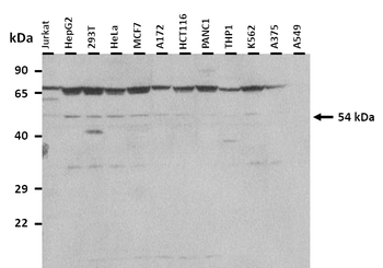 SLC38A1 Rabbit Polyclonal Antibody