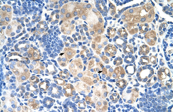 SLC38A1 Rabbit Polyclonal Antibody