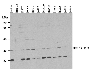 SLC25A4 Rabbit Polyclonal Antibody