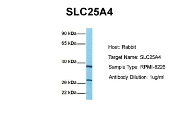 SLC25A4 Rabbit Polyclonal Antibody