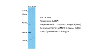 SLC25A4 Rabbit Polyclonal Antibody