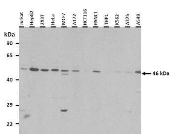 SLC37A4 Rabbit Polyclonal Antibody