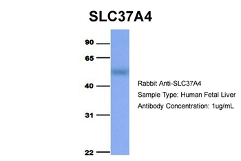 SLC37A4 Rabbit Polyclonal Antibody