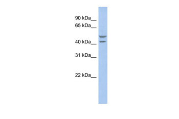 SLC37A4 Rabbit Polyclonal Antibody